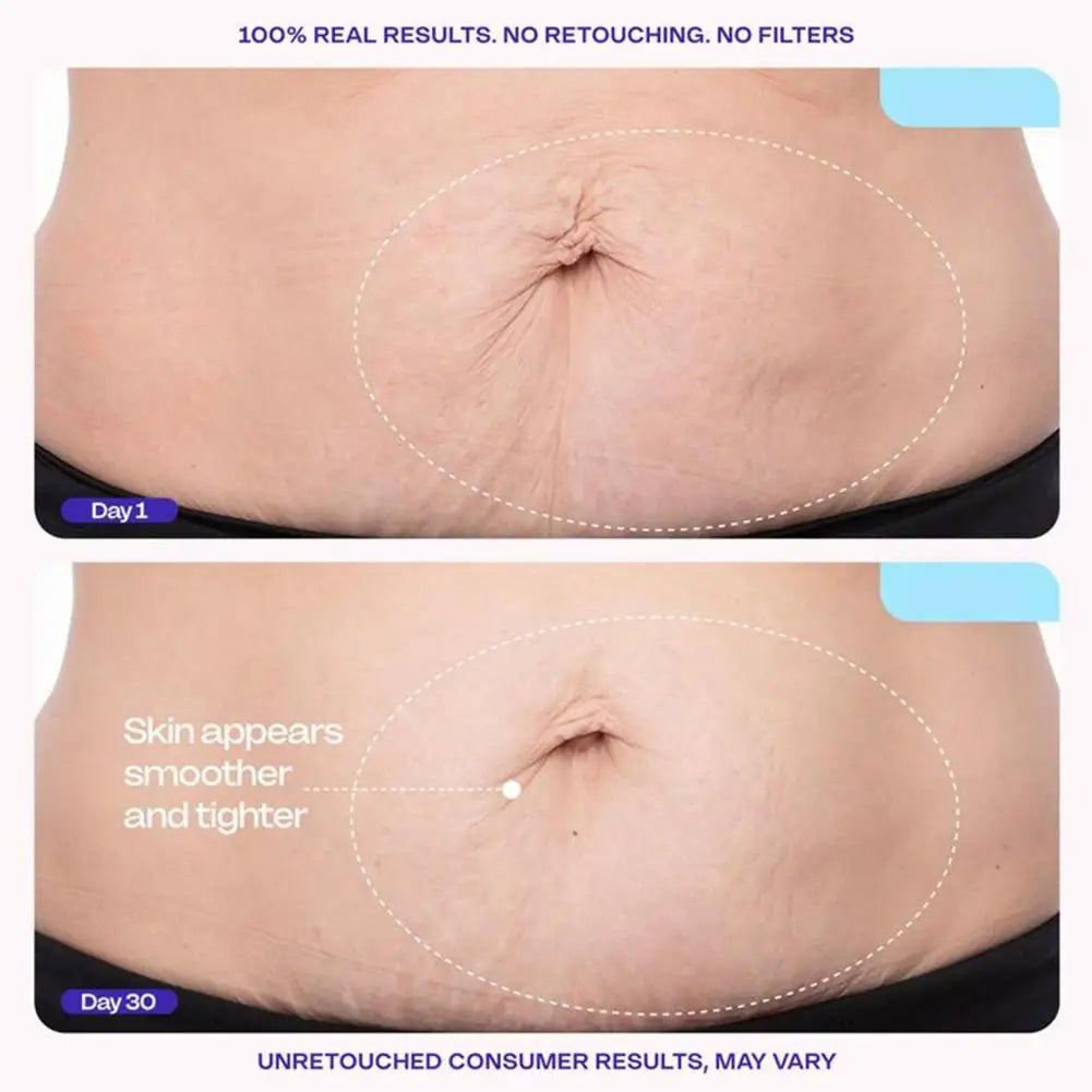 Belly Shaping Lotion Plant Essence Gentle Non Irritating Moisturizing Smoothing Improve Skin Toughness Anti Sagging Body Care