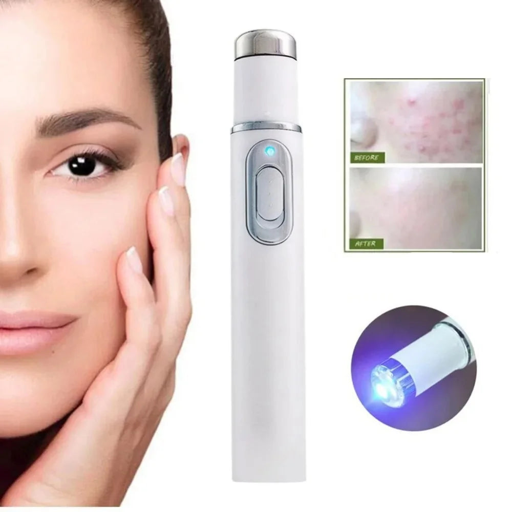 Eye Massager Facial Beauty Device Eye Massager Blue Light Black Eye Circles Facial Care Lightening Texture Maintaining Eye Bags