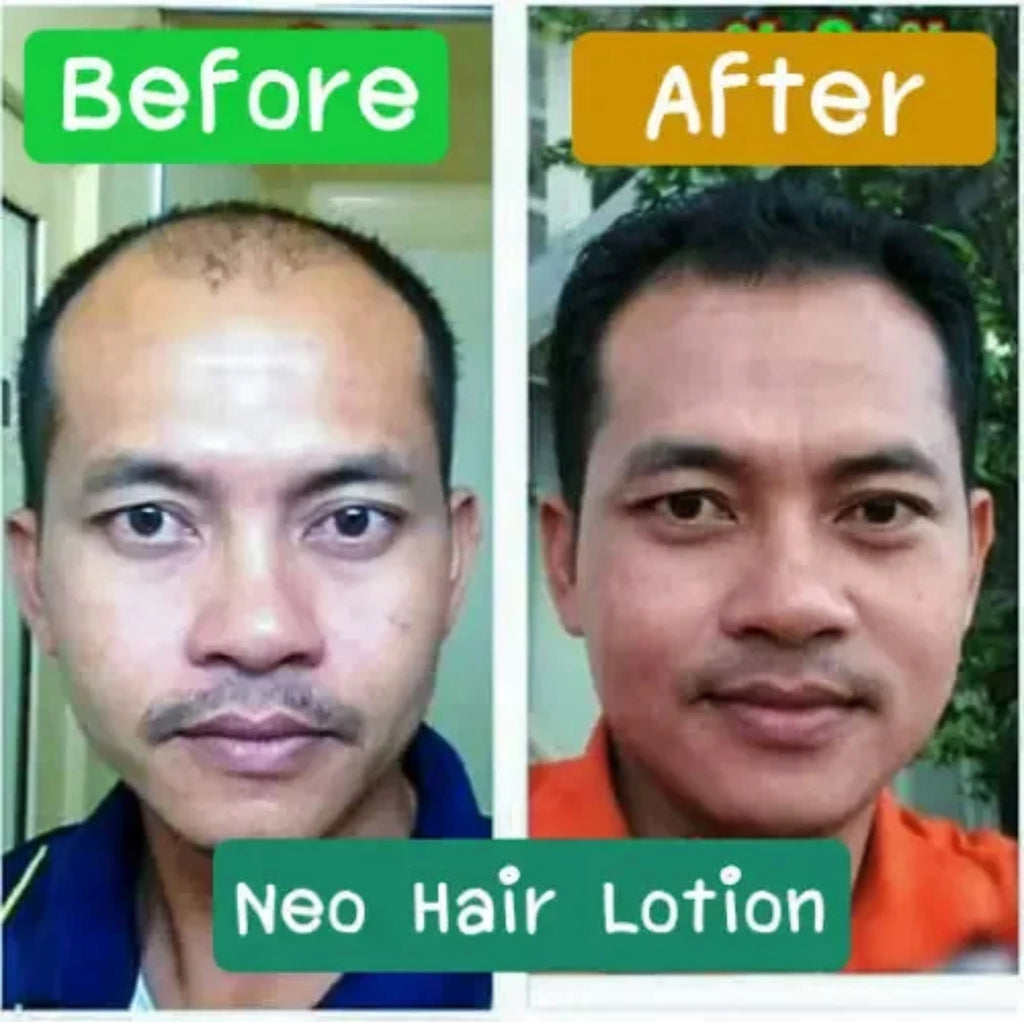 Neo hair lotion hair care oil care hair roots 120mL