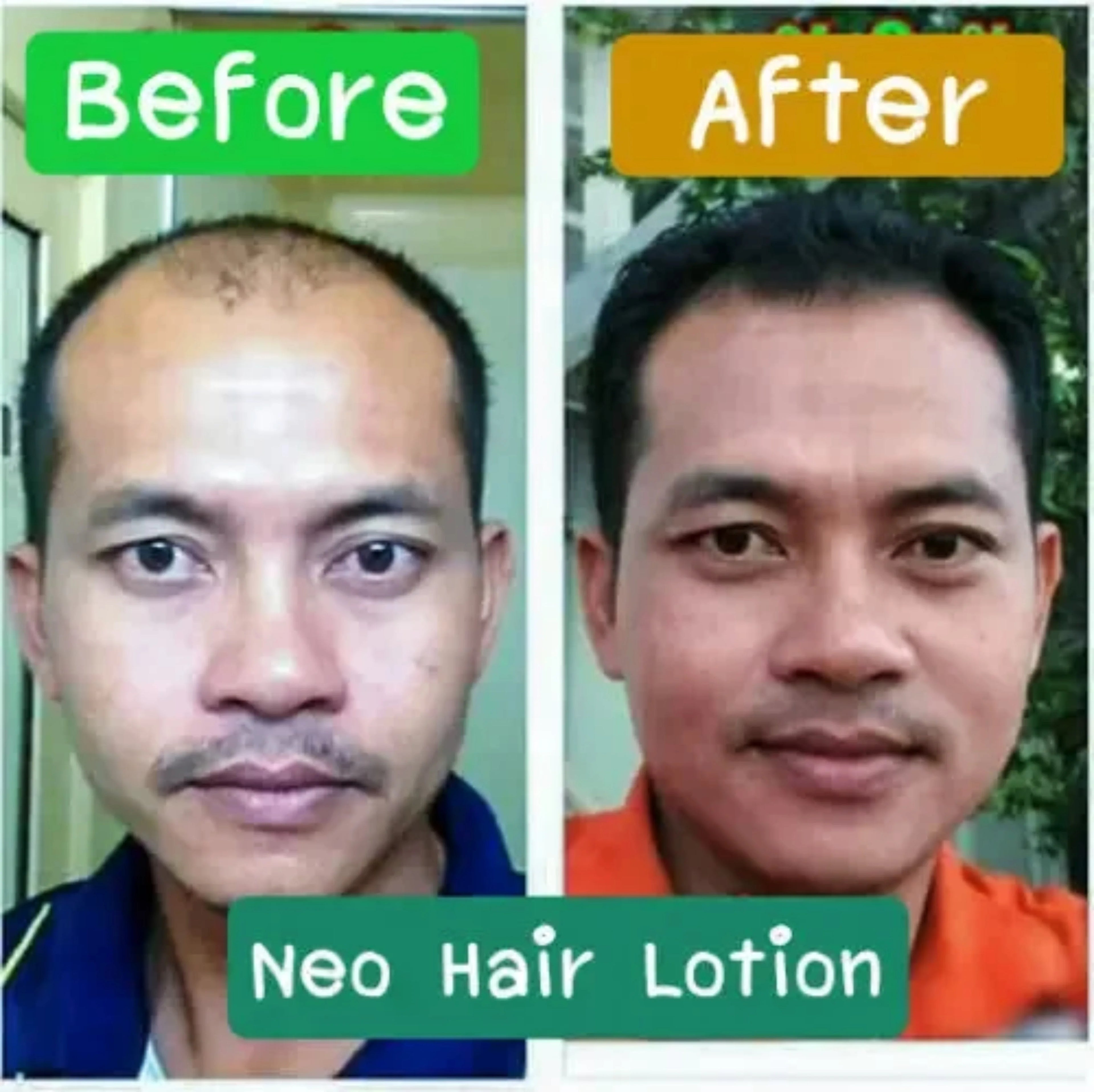 Neo hair lotion hair care oil care hair roots 120mL