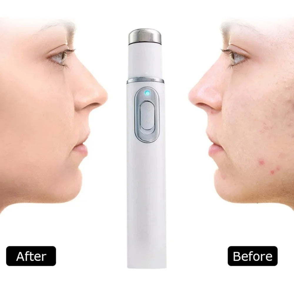 Eye Massager Facial Beauty Device Eye Massager Blue Light Black Eye Circles Facial Care Lightening Texture Maintaining Eye Bags