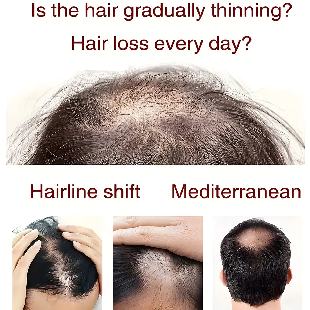 YUITIKUE Moroccan Hair Oil, Rosemary & Argan Infused, Anti Hair Loss, Nourish Scalp & Strengthen Roots