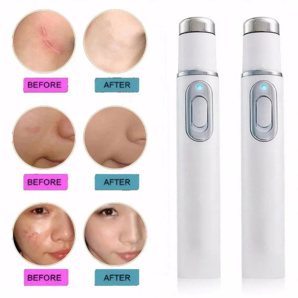 Eye Massager Facial Beauty Device Eye Massager Blue Light Black Eye Circles Facial Care Lightening Texture Maintaining Eye Bags