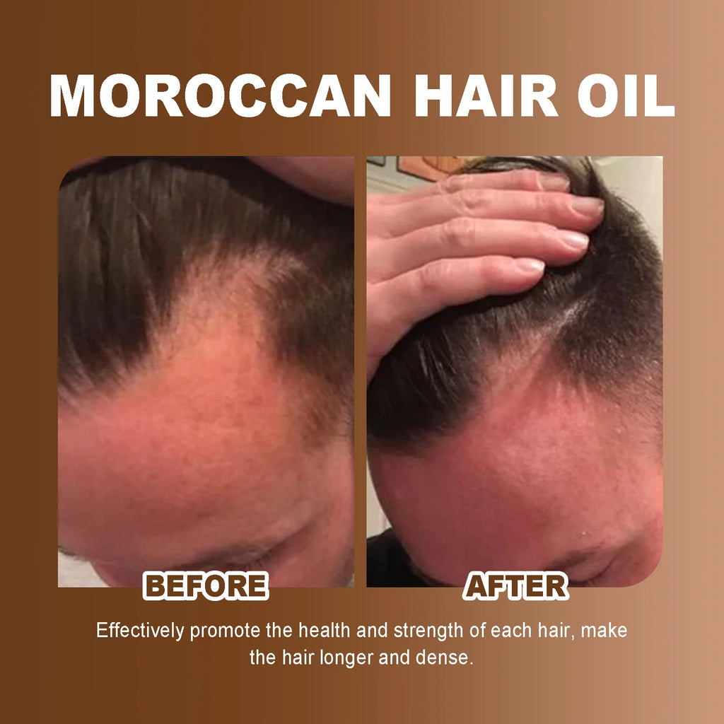 HOEGOA 100mL Moroccan Hair Oil Effectively Promotes Hair Health Reduces Breakage Moisturizing Reduces Dryness Hair Treatment Oil