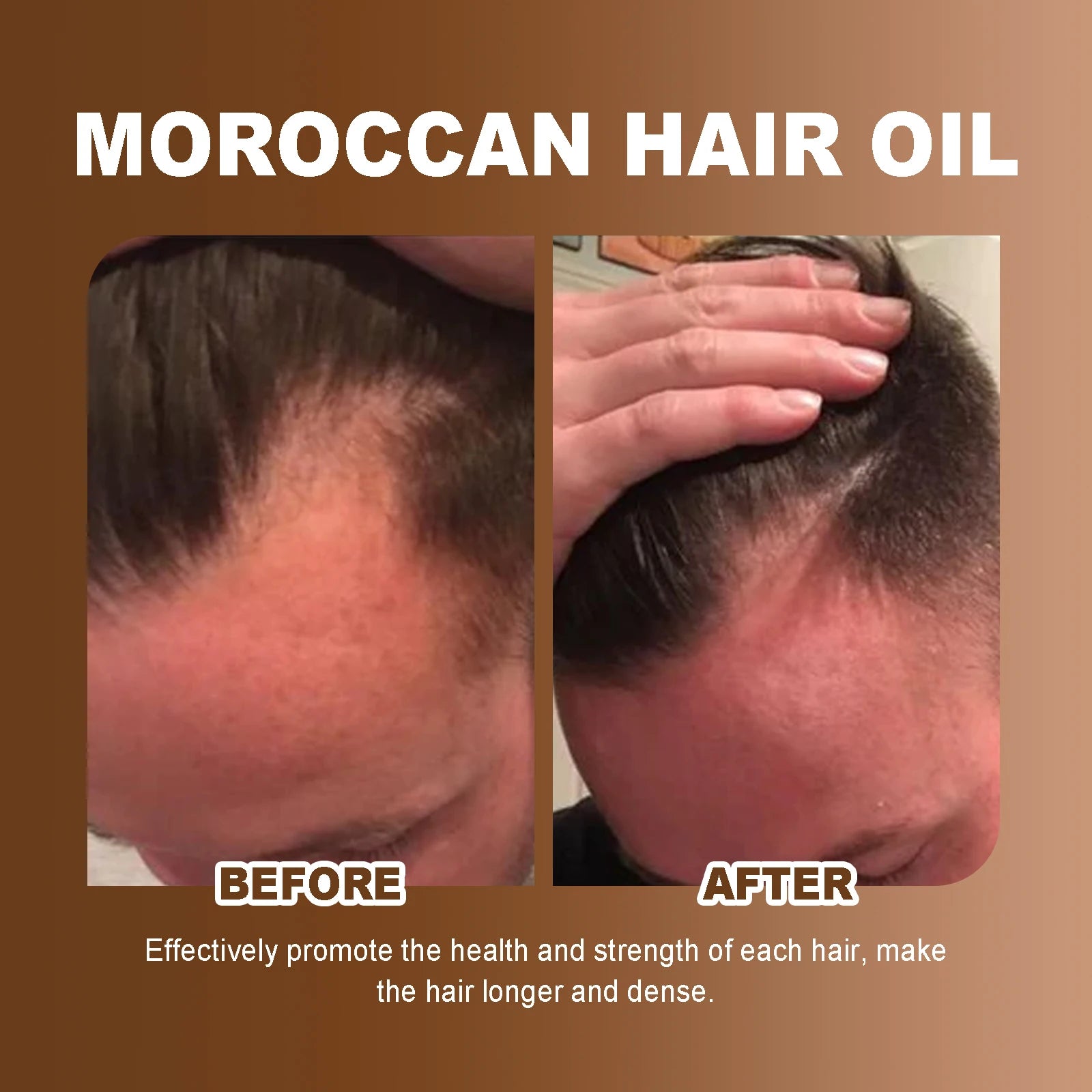 HOEGOA 100mL Moroccan Hair Oil Effectively Promotes Hair Health Reduces Breakage Moisturizing Reduces Dryness Hair Treatment Oil