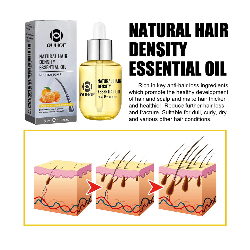 Ouhoe Hair Care Oil for Thinning Hair Scalp Treatment Serum to Strengthen Roots and Repair Damaged Hair 30ml Natural Formula
