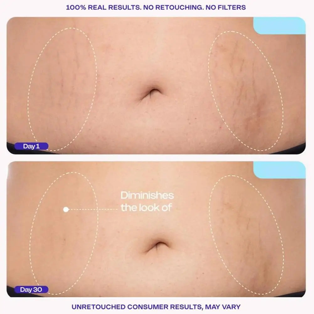 Belly Tightening Body Cream Natural Plant Essence Mild Nourishing Hydrating Boost Skin Elasticity Anti Sagging Body Shaping Care
