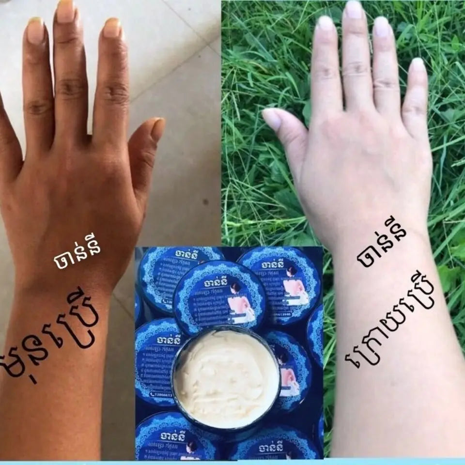 Thai-Cambodian Whitening Cream 280g/Bottle -Moisturizing Brightening Face Body Care Luxury
