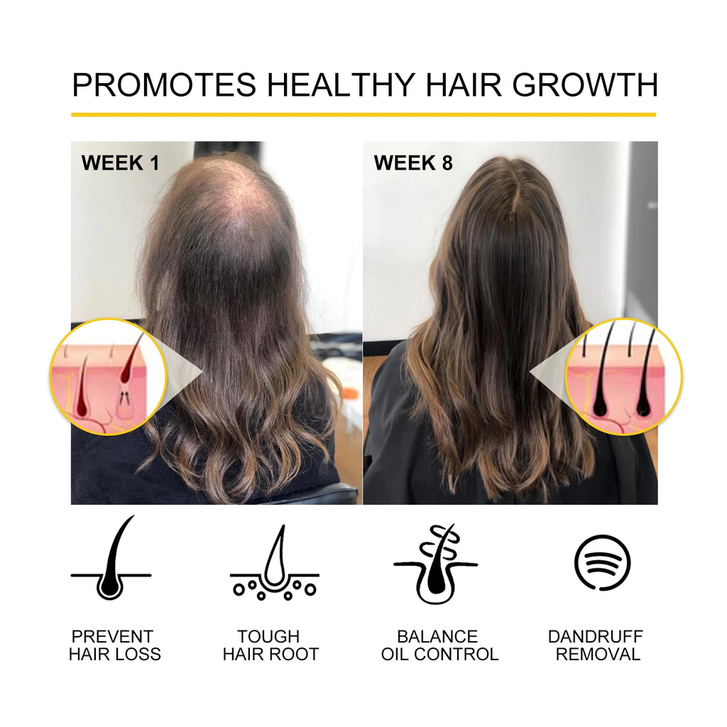 Ouhoe Hair Care Oil for Thinning Hair Scalp Treatment Serum to Strengthen Roots and Repair Damaged Hair 30ml Natural Formula