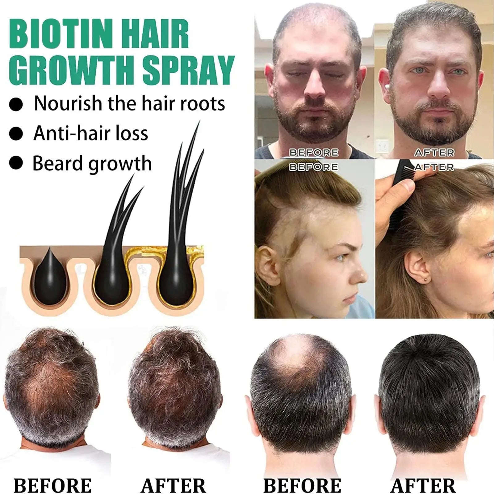 Hair Thickening Care Products Scalp Repair Hair Thicken Conditioner Beard Thickening Care Oil Serum Professional Hair Care