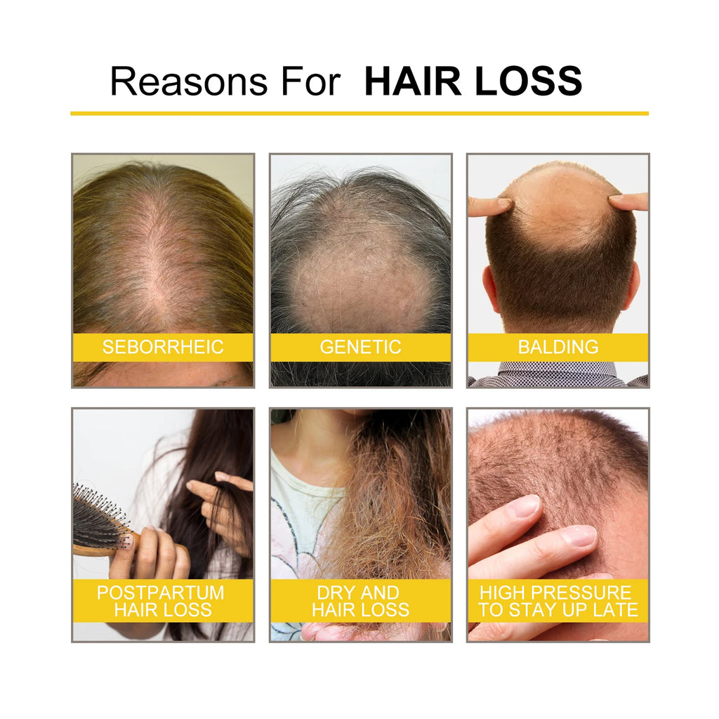 Ouhoe Hair Care Oil for Thinning Hair Scalp Treatment Serum to Strengthen Roots and Repair Damaged Hair 30ml Natural Formula