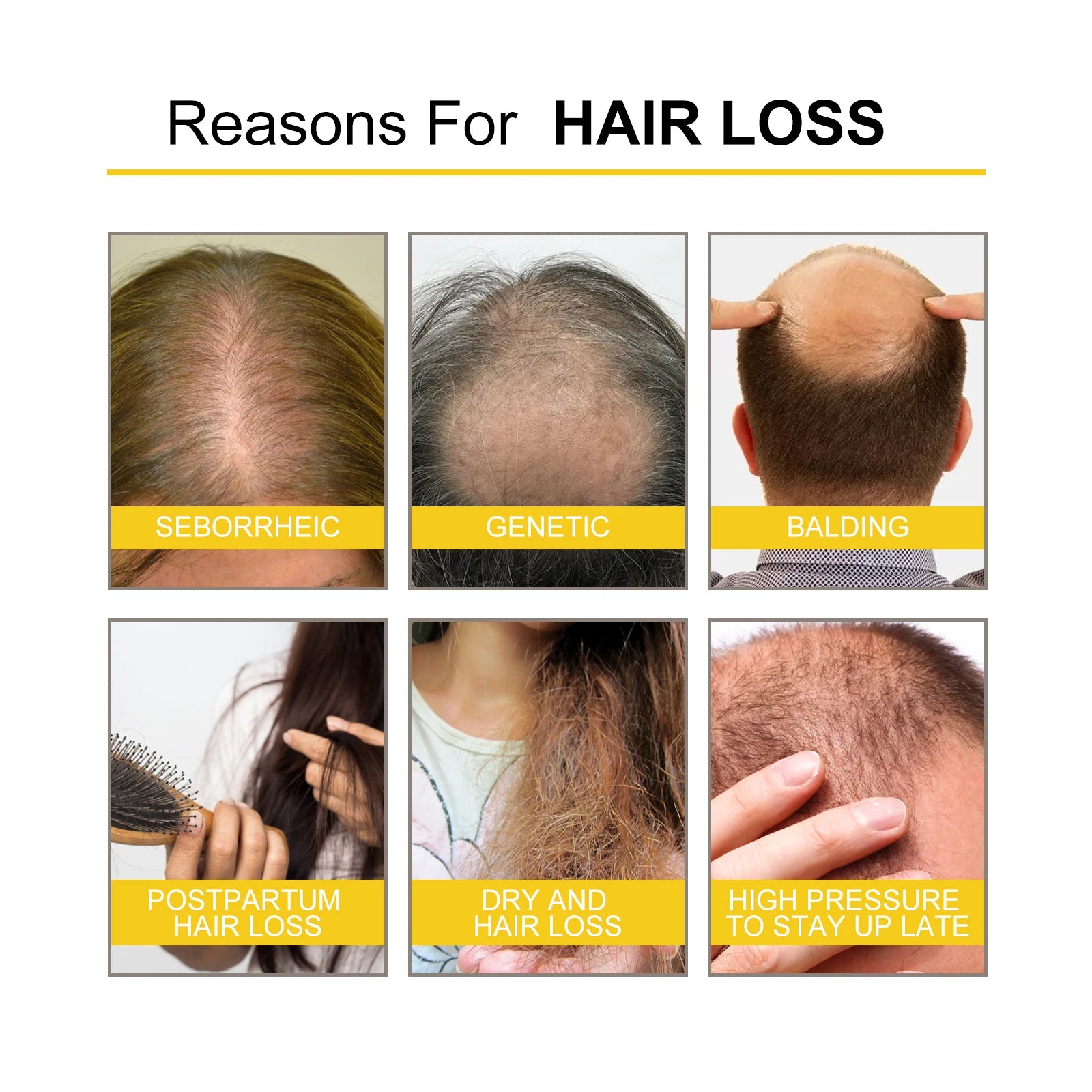 Ouhoe Hair Care Oil for Thinning Hair Scalp Treatment Serum to Strengthen Roots and Repair Damaged Hair 30ml Natural Formula