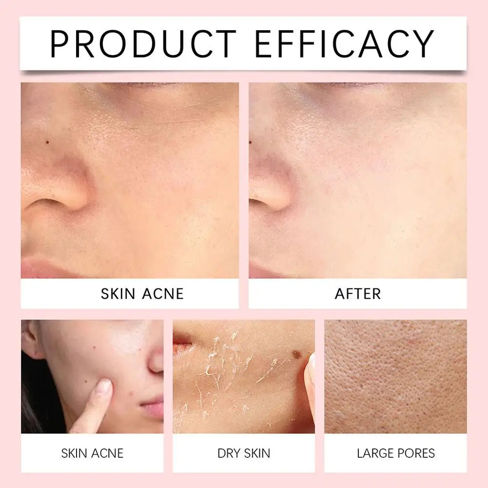 Centella Asiatica Deep Cleansing Foam Cleanser For Women Pore Shrinking Oil Control Barrier Repair Daily Facial Skin Care
