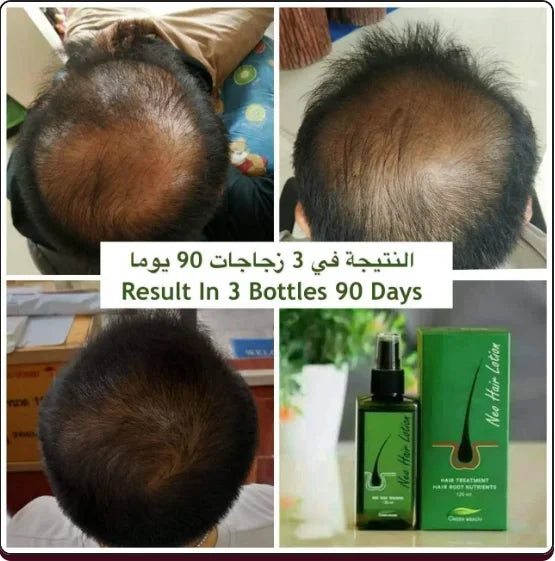 Neo hair lotion hair care oil care hair roots 120mL