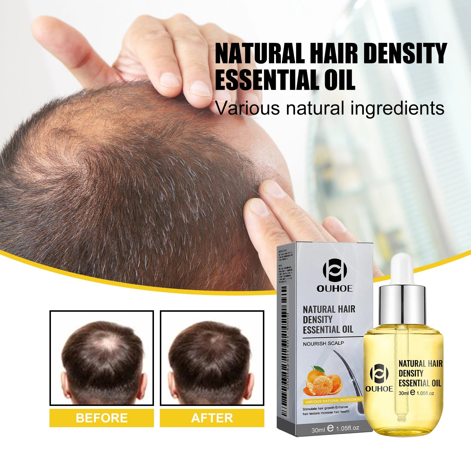 Ouhoe Hair Care Oil for Thinning Hair Scalp Treatment Serum to Strengthen Roots and Repair Damaged Hair 30ml Natural Formula