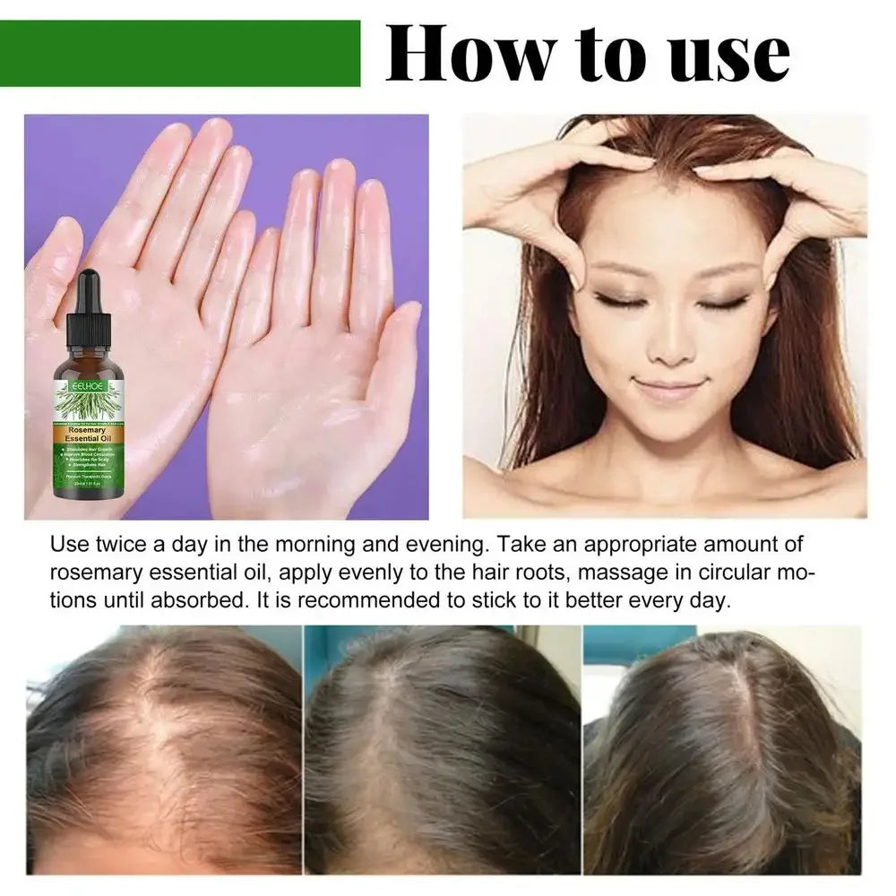 Rosemary Essentiall Oil Hair Growth Products Organic  Products Scalp Hair Strengthening Oil For Nourish Shiny  Healthy