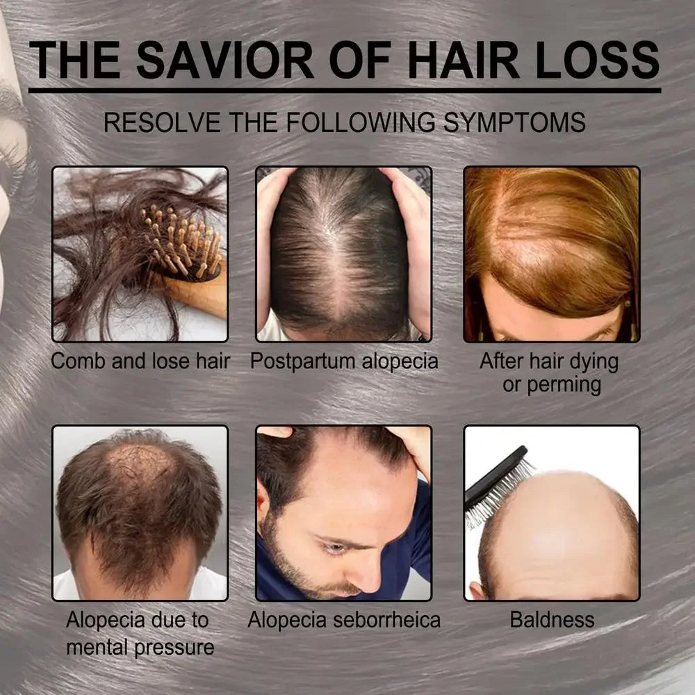 Rosemary Essentiall Oil Hair Growth Products Organic  Products Scalp Hair Strengthening Oil For Nourish Shiny  Healthy