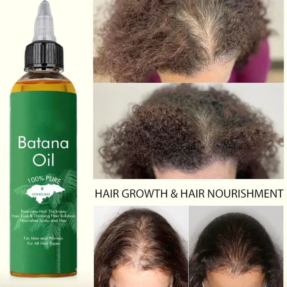 Batana Hair Care Essential Oil Repair Hair Root Moisturize Nourishing Strengthen Improve Split Smooth Hair Care Oil